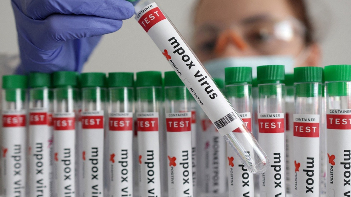 Guinea-Bissau Reports First Mpox Case as Health System Mobilises Response