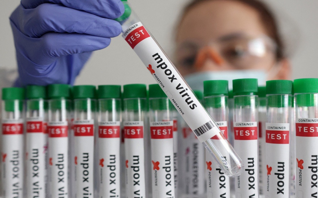 Guinea-Bissau Reports First Mpox Case as Health System Mobilises Response