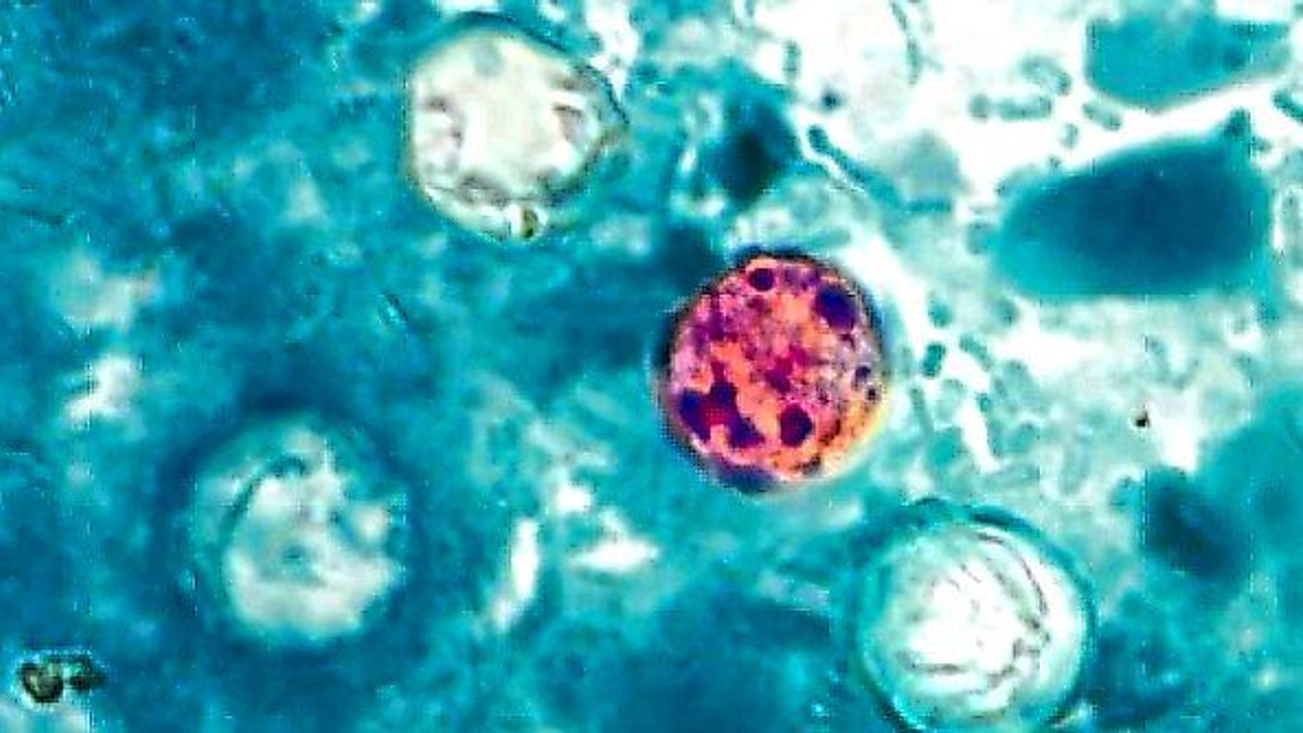 The Hidden Enemy: Why Cyclospora Parasites Remain Mysteriously Hard to Track