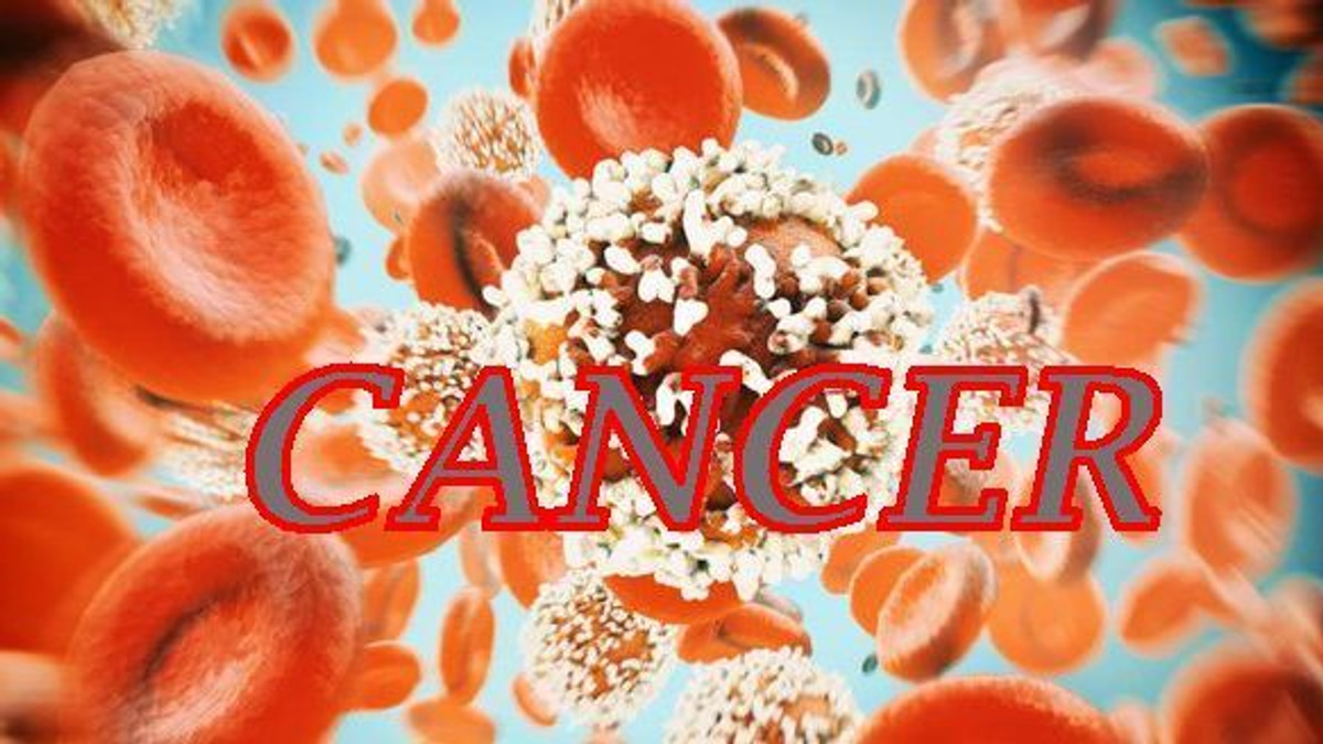 The Silent Threat: Why Colorectal Cancer Is Striking Younger Malaysians