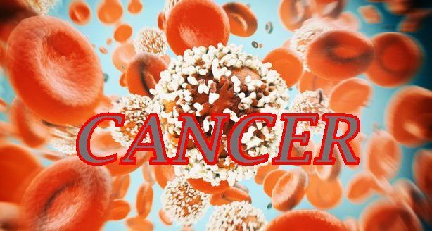 The Silent Threat: Why Colorectal Cancer Is Striking Younger Malaysians