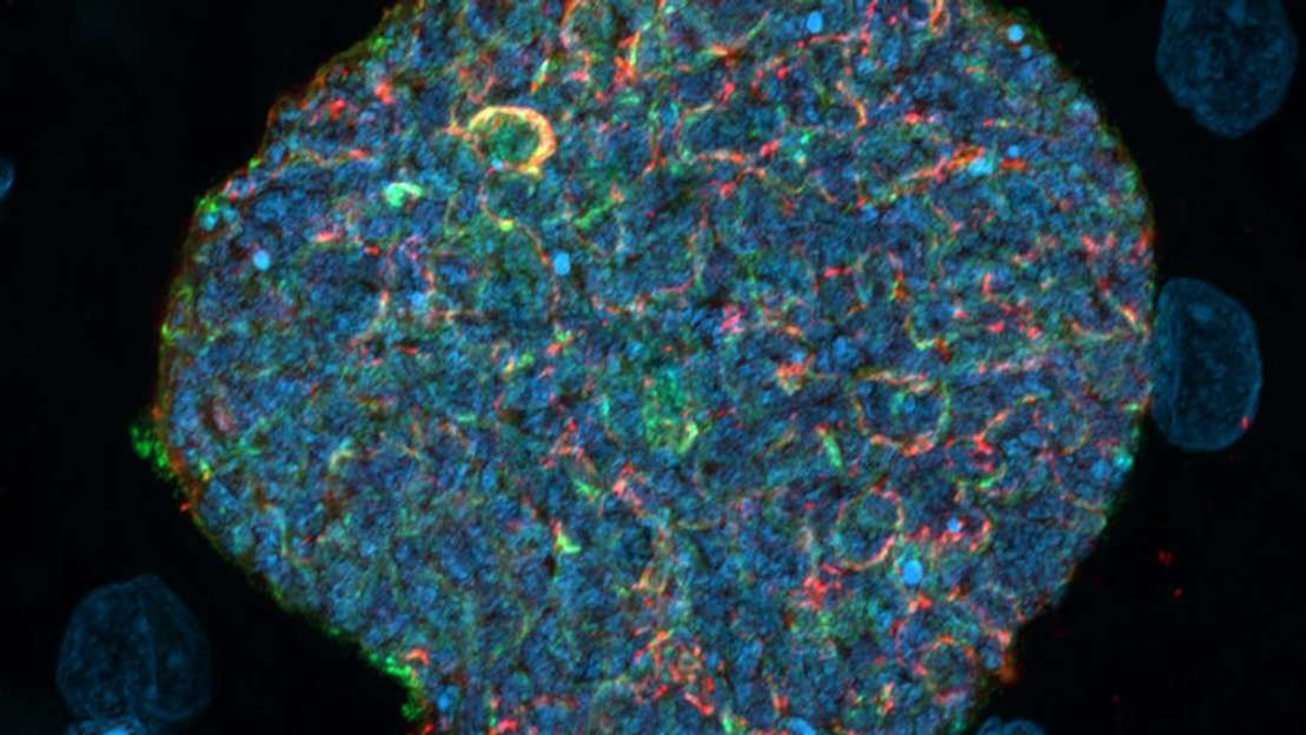 Australian Researchers Turn Mosquito Bites Into Malaria Protection Strategy